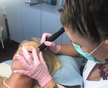 Plasma Pen Plasma Pen